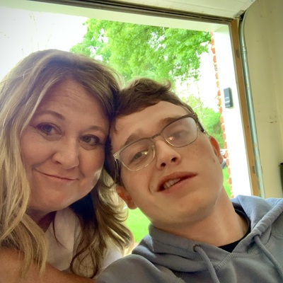 DIPG is cruel as it disfigures the body, drooping the smile and turning the eye in